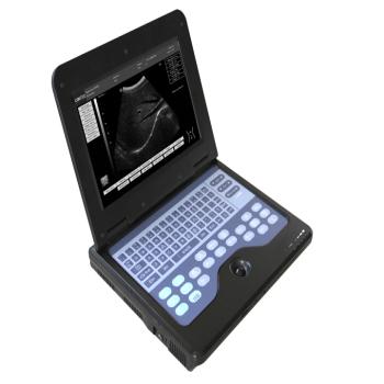 cms600p2b型笔记本式超声诊断仪/b超机_价格/说明/厂家/公司-3618医疗